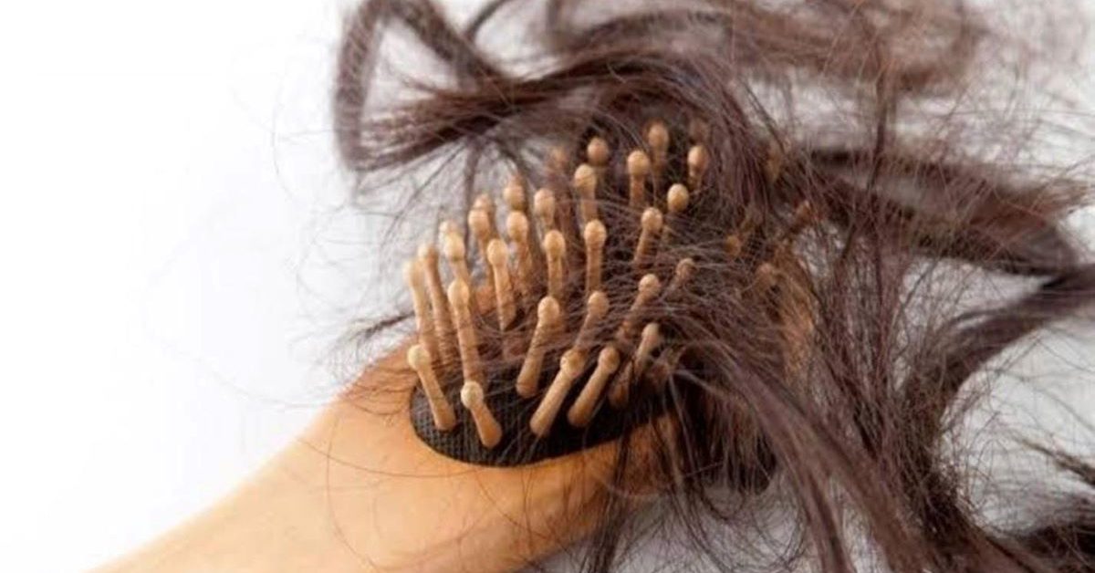 اسباب تساقط الشعر عند النساء وطريقة علاجها